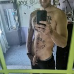 Analloverpas