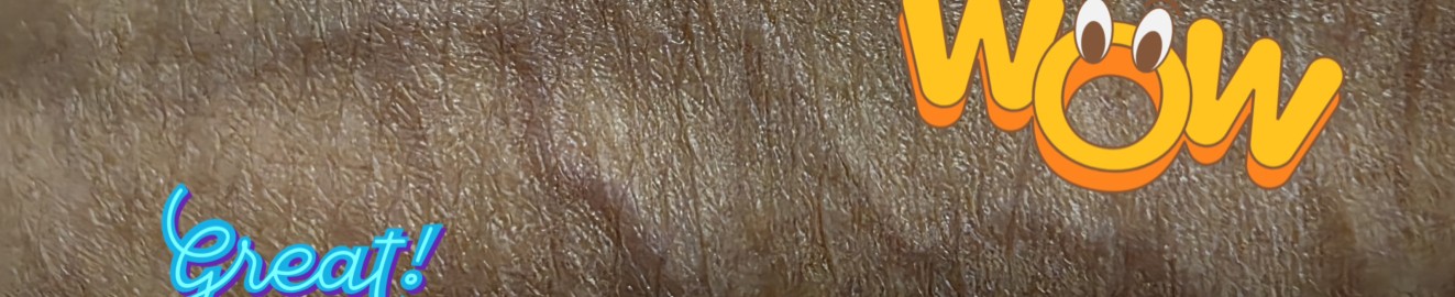ACruoreX