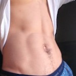 Ddick3