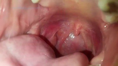 VERY Sexy Redhead's HUGE Mouth POV