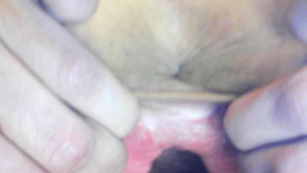 teen gaping cunt and showing cervix