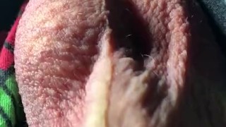 Moving testicles