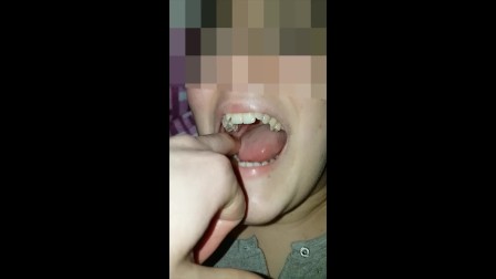 Girl bites fingers Very Hard