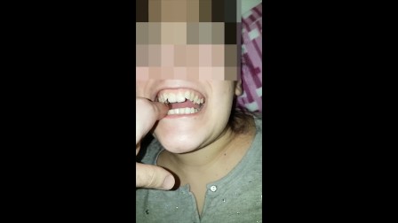 Girl bites fingers Very Hard