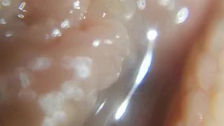 head and foreskin superzoom