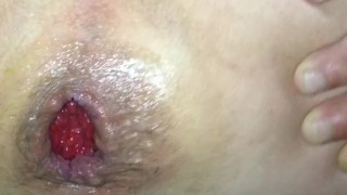 gaping anal whit a squash