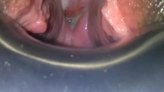 NYC thot Speculum play while ovulating p1 