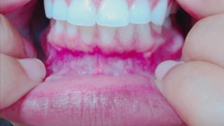 Teeth Fetish Examination