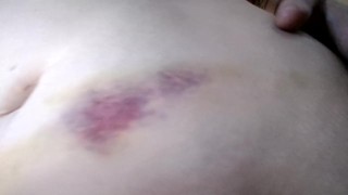 After Car Accident (2016)