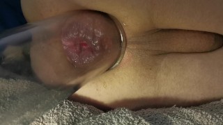 Anal pump and juicy rosebud