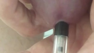 Penetration uretre