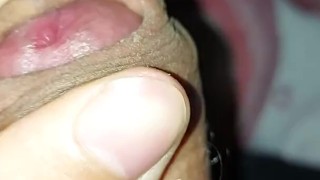 Foreskin