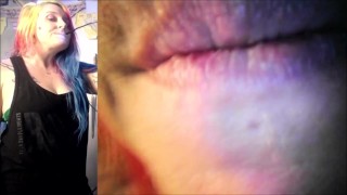 Vore Endoscopy