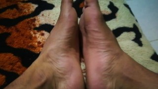 My feet after walking 2 hours