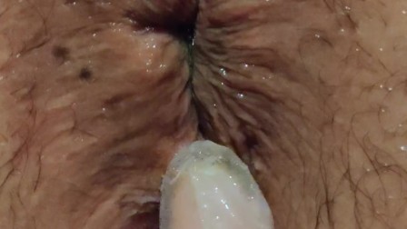 anal SLUT PART 5. Expanding the boundaries, fucking this hole with our hand!