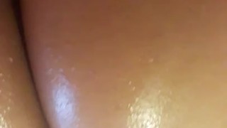 CULO ACEITOSO