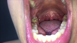 Mouth exam in front of the camera (Short version)