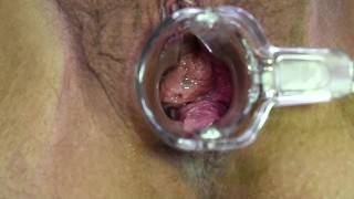 MILF allowing you to get a good look inside pussy.