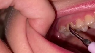 Ultrasonic teeth cleaning. Teeth fetish.