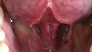 SFW Behind the Scenes look at my newly untied tongue immediately before & after surgery today 