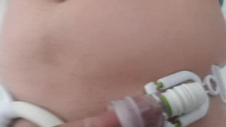 PHALLOSAN FORTE Jour 1 début du traitement ! 