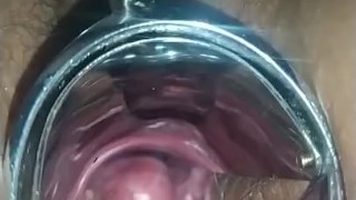 Ginecólogo va a mi casa y me filma