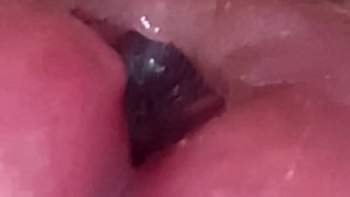 Urethral Examination 