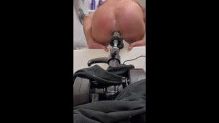 Rough anal