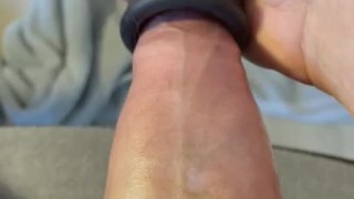 Thick veins