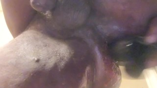 Prostate milking