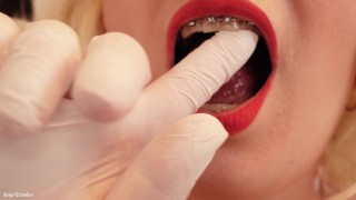 Medical Gloves, sexy braces and hot pussy - fetish video of sexy MILF