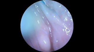 DP Endoscope for Andrew