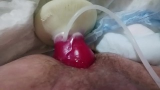 Knotting paraplegic ass