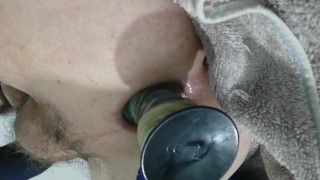 Anal Inflable Extremo Prolapso