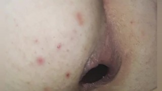 Huge extreme Anal gaping 3" black ball insertion and huge anal prolapse.hot anal compilation #1 2024