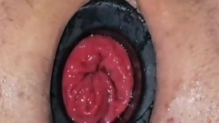 Dilatador anal rosebud