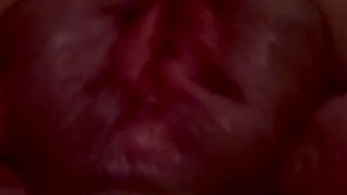 Rosebudding Asshole